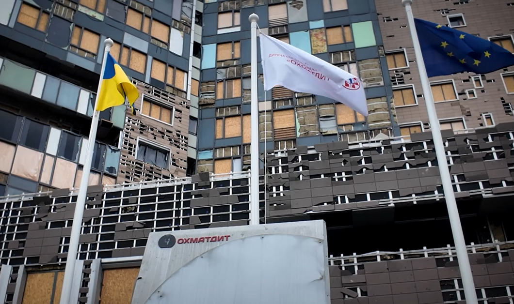 Надсучасний УЗД апарат для дитячої лікарні «Охматдит»